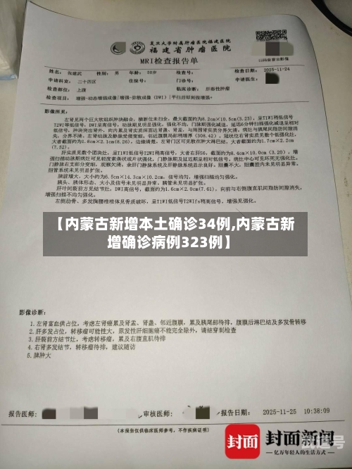 【内蒙古新增本土确诊34例,内蒙古新增确诊病例323例】